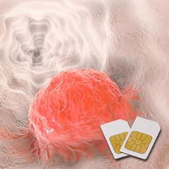 Ein orange-rot markierter Tumor in einer weissen Speiseröhre, Computergrafik