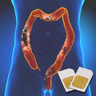 Chipcard COLITIS für Diamond Shield Zapper Chipcard COLITIS für Diamond Shield Zapper